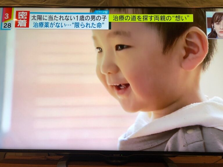 陽の光を浴びられない新貝海陽（うみひ）くん、難病克服へ「全ての浜松市民に知って欲しい」 浜松びいき